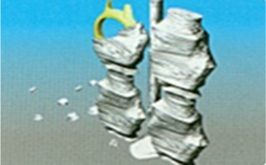 Lost Wax Casting(15) Lost Wax Casting(15)